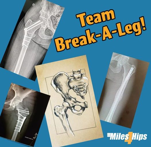 Team Break-A-Leg!