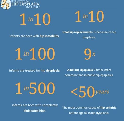 What is Hip Dysplasia?